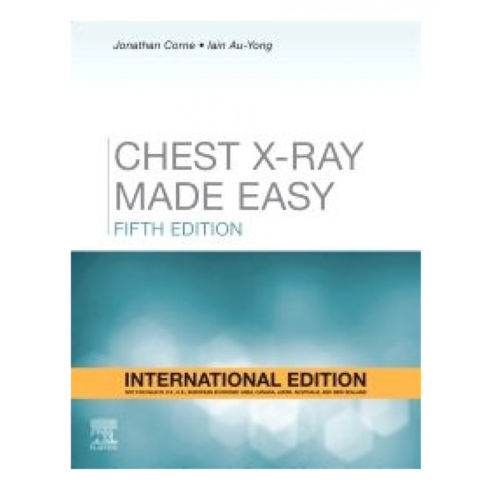 Chest XRay Made Easy;5th(International)Edition 2022 By Jonathan Corne